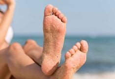 Pies felices en verano: cuidados esenciales para mantenerlos sanos y libres de problemas