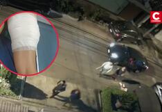 Modelo es atacada por rottweiler en Chorrillos y vecinos exigen medidas