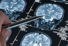 ¿A qué edad comienza el Alzheimer? Estudio revela cambios cerebrales desde los 50 años