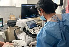 Piura: En Hospital Santa Rosa realizan primer estudio del corazón en tiempo real con moderna tecnología