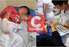 Chincha: piden apoyo para niño que perdió un dedo tras explosión de pirotécnico “calaverita”