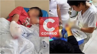 Chincha: piden apoyo para niño que perdió un dedo tras explosión de pirotécnico “calaverita”