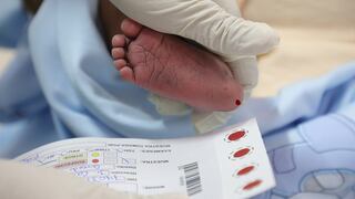 Pruebas de tamizaje neonatal: Se realizan a partir de las 48 horas de nacido el bebé 
