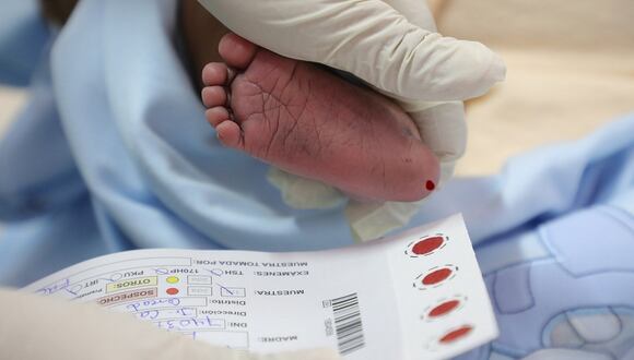 Especialista señala que la muestra de sangre de talón debe tomarse después de las 48 horas de nacido el bebé.