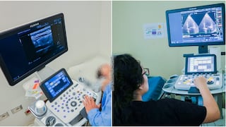 Ica: fortalecen atención especializada con nuevos equipos biomédicos de alta tecnología