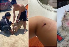 Ica: mujer sufre mordedura de perro pitbull en la playa Carhuaz