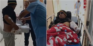 Hombre sufrió corte profundo y casi pierde el brazo tras accidente con amoladora