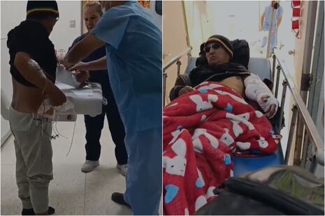 Hombre sufrió corte profundo y casi pierde el brazo tras accidente con amoladora