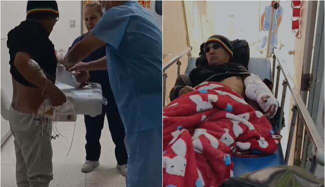 Hombre sufrió corte profundo y casi pierde el brazo tras accidente con amoladora