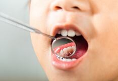 Mitos sobre los dientes de leche: ¿Cómo afectan la salud dental de los niños?