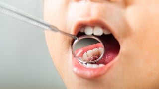 Mitos sobre los dientes de leche: ¿Cómo afectan la salud dental de los niños?