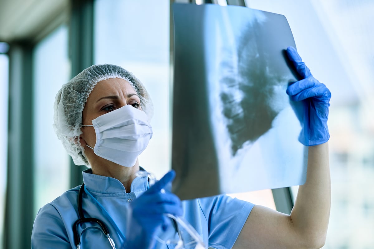 Aunque generan dudas, las radiografías usan dosis mínimas de radiación, comparables a unos días de exposición natural, y son seguras si se realizan bajo justificación médica.