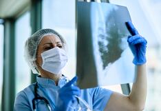 ¿Las radiografías son peligrosas para la salud? Esto es lo que debes saber