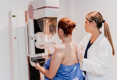 Día Mundial de la Salud: 70% de mujeres en Perú es diagnosticada con cáncer en etapas avanzadas