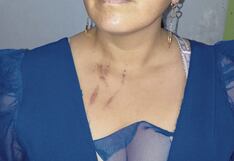 Mujer denuncia al alcalde de Cuenca por salvaje agresión