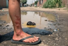 Más de 500 establecimientos de salud de Junín en alerta por 18 casos de Leptospirosis