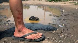 Más de 500 establecimientos de salud de Junín en alerta por 18 casos de Leptospirosis