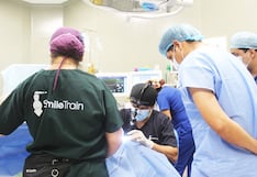 Piura: Hospital de Sullana lanza campaña gratuita de cirugías de labio y paladar hendido