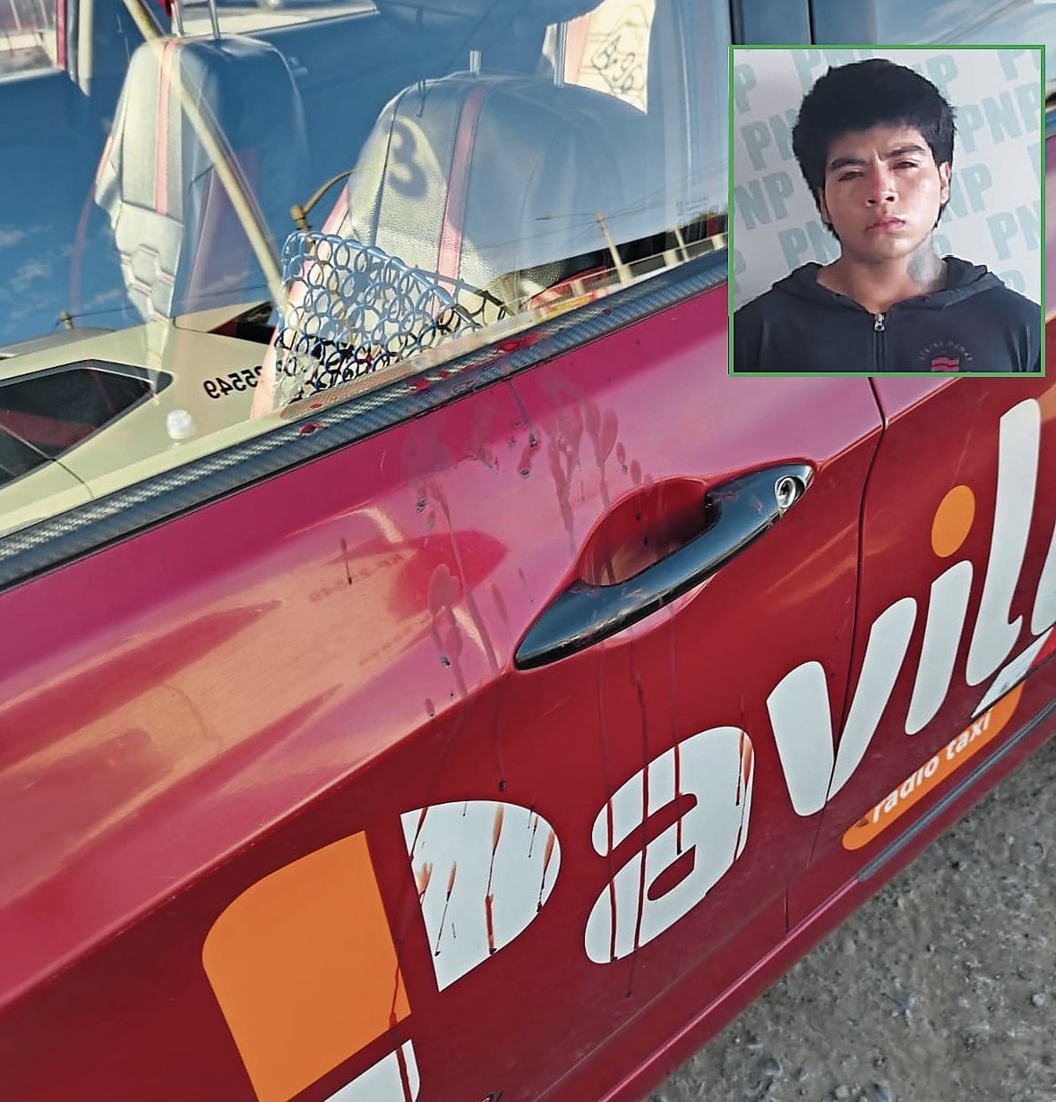 Conductor de radiotaxi Pavill fue socorrido por policías y llevado al hospital Hipólito Unanue con heridas en el rostro, cabeza, oreja y hombro. (Foto: Difusión)