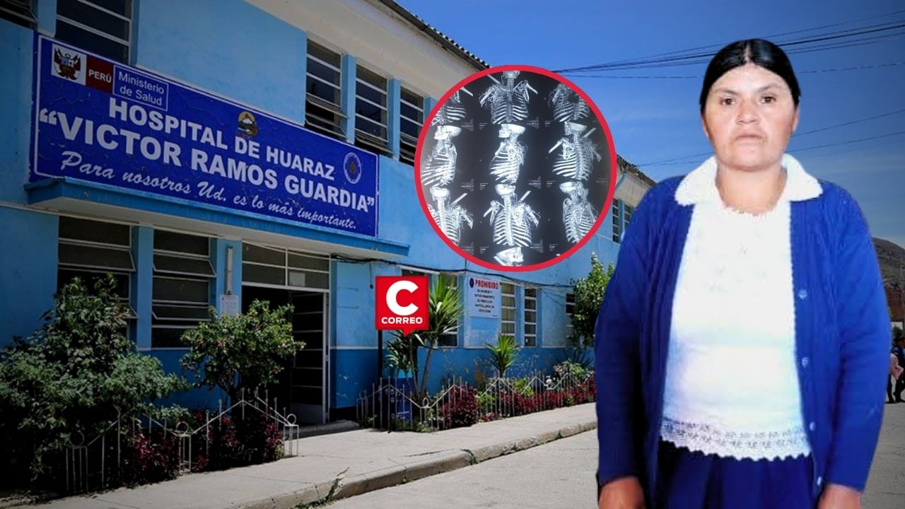 Huaraz: Madre en estado crítico con fierro incrustado cerca del corazón será evacuada a Lima. Composición: Diario Correo.