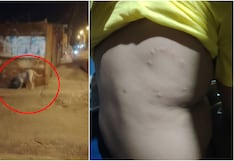 Ica: niño de 9 años es atacado por un pitbull en Los Espinos