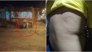 Ica: niño de 9 años es atacado por un pitbull en Los Espinos
