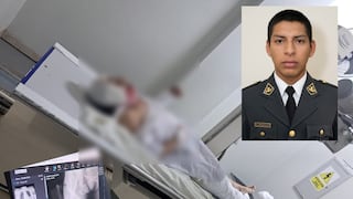 Chiclayo: adulta mayor queda grave tras ser atropellada presuntamente por policía