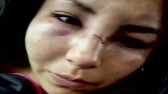 Violencia contra la mujer: efectivo del Ejército le desfigura el rostro a su expareja