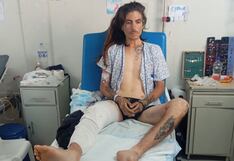 Ica: ciudadano argentino atropellado denuncia irregularidades tras accidente de tránsito