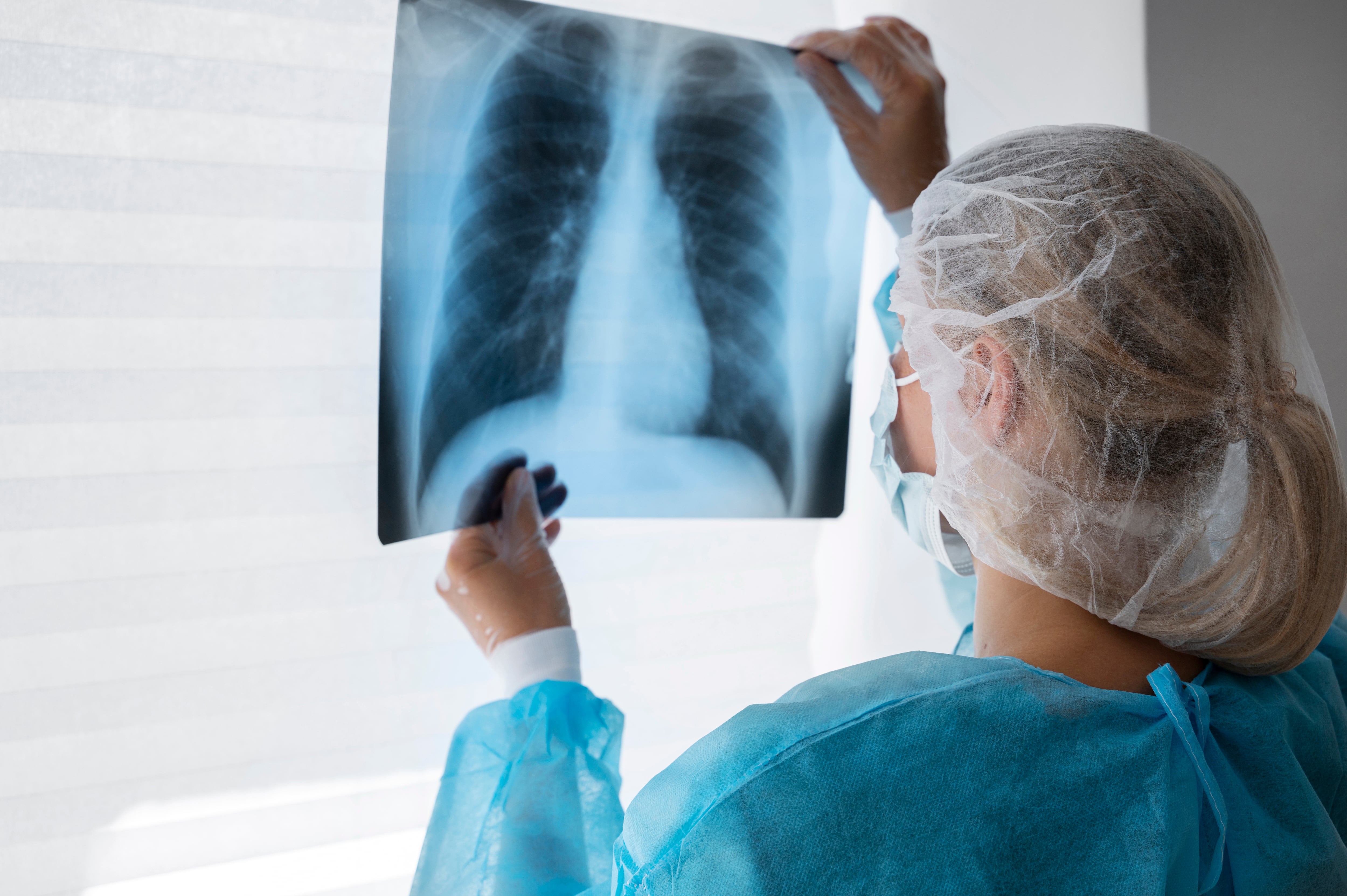 Un análisis a siete años del estudio CROWN mostró que el 55% de pacientes con cáncer de pulmón ALK positivo tratados con lorlatinib permanecieron sin progresión de la enfermedad.
