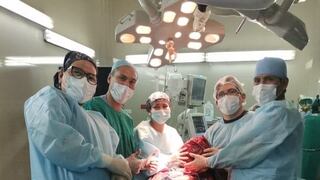 Extraen tumor de 17 kilos a mujer de 40 años en Arequipa