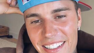 Justin Bieber sufre parálisis facial: ¿Por cuánto tiempo estará alejado de los escenarios?