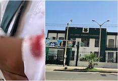 Chincha: alumno salva de morir tras recibir bala perdida en la I. E. José Pardo y Barrera