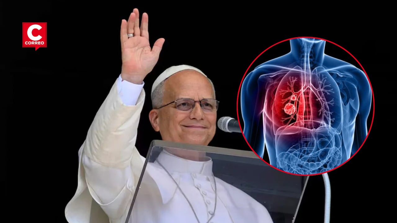 Diagnóstico temprano favorecería la recuperación del papa León XIV.