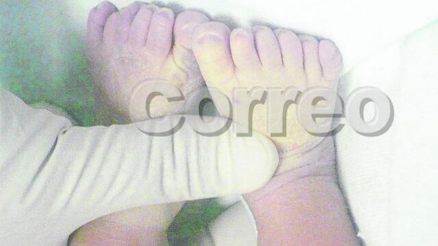 Niño nace con 24 dedos y otras malformaciones