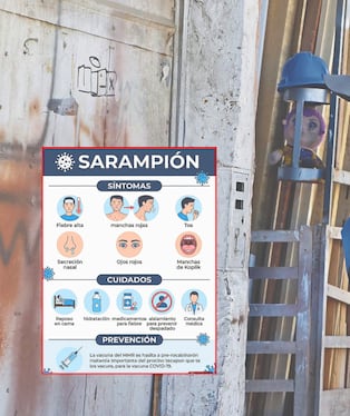 A tener cuidado con los síntomas del sarampión. Foto: Composición GEC.