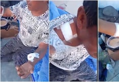 Jauría de perros casi mata a pescador y lo deja gravemente herido