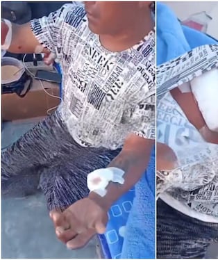 Jauría de perros casi mata a pescador y lo deja gravemente herido