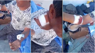 Jauría de perros casi mata a pescador y lo deja gravemente herido