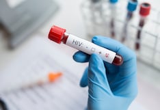 Vivir con VIH en Perú: avances médicos y nuevas estrategias para mejorar la calidad de vida