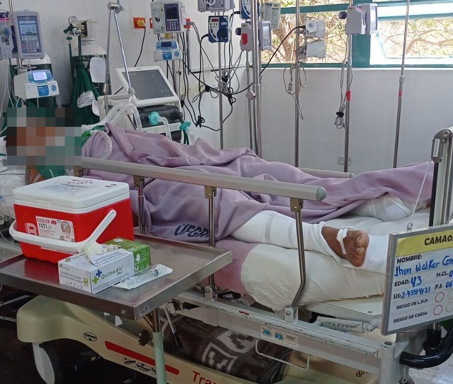 Jhon Walker Condori recibió dos balazos y tuvo que ser intervenido quirúrgicamente en el hospital Unanue