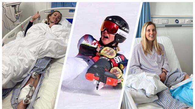 JJ. OO. de Invierno: esquiadora cayó en un descenso y se fracturó la pierna (VIDEO)