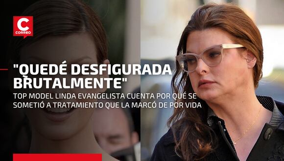 Linda Evangelista: la modelo top que terminó "brutalmente desfigurada" tras tratamiento estético