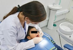 Caries afecta a 9 de cada 10 niños en Arequipa y médicos advierten riesgos