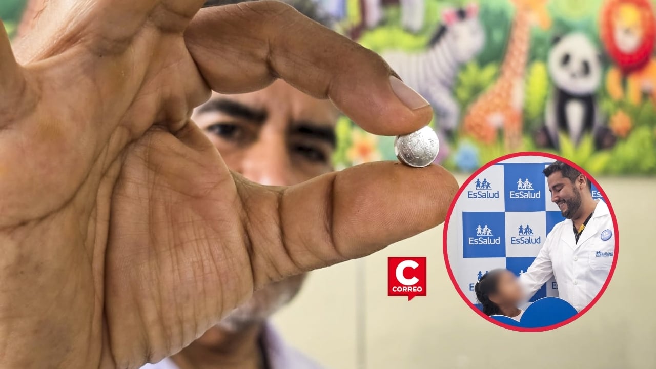 Médicos del Hospital Sabogal realizaron exitosa cirugía a niña con intestino perforado tras ingerir una pila. Composición: Diario Correo. Fotos: Seguro Social de Salud.