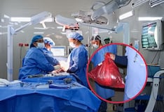 Médicos del hospital Goyeneche extirpan tumor de gran tamaño