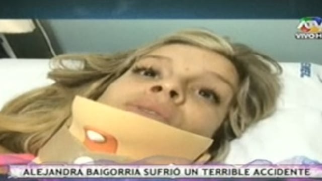 Alejandra Baigorria luego de accidente: "Sentí que me iba a morir"