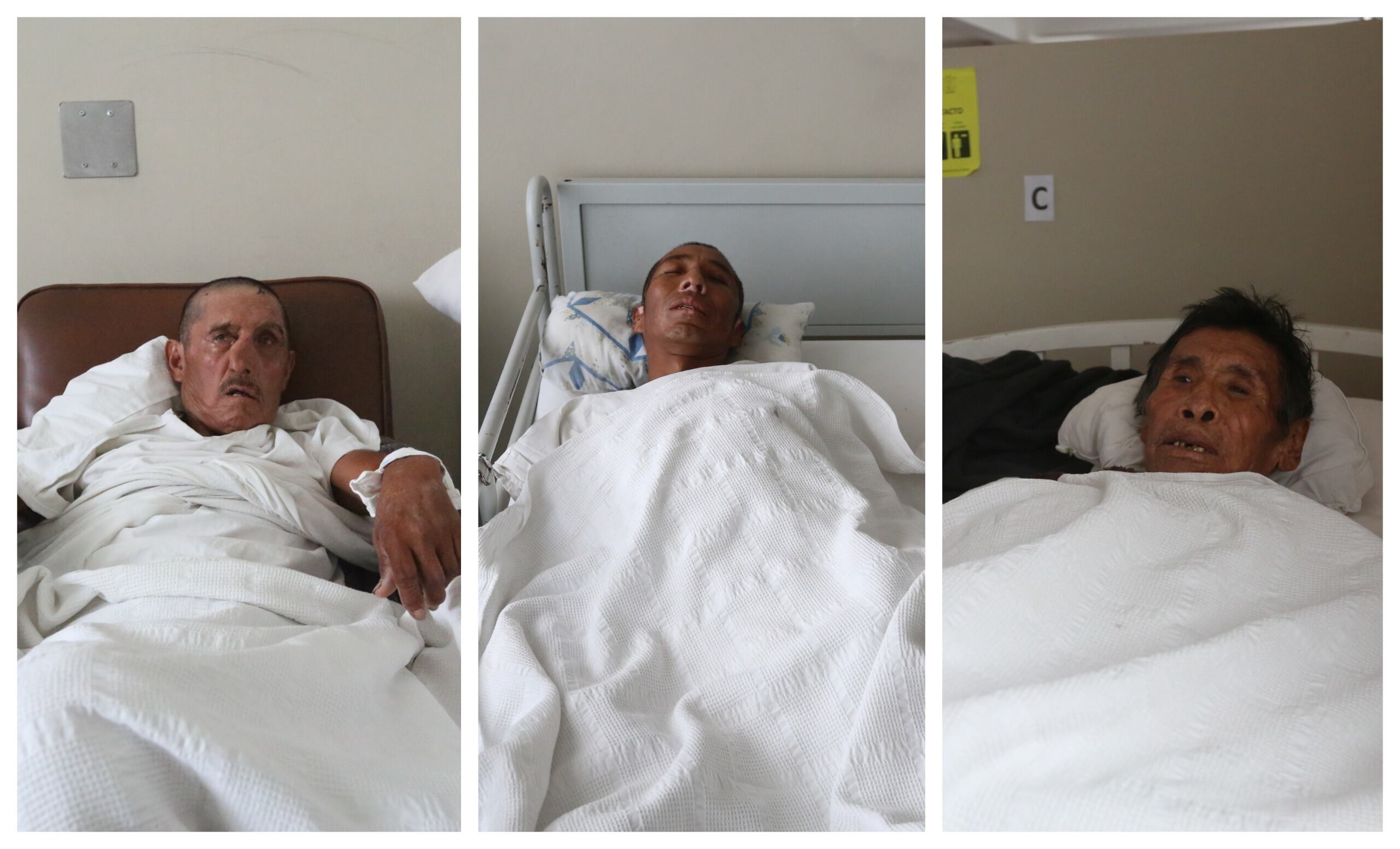 Varones se encuentran internados en el cuarto y quinto piso del hospital Honorio Delgado. (FOTO: Leonardo Cuito)