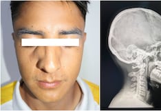 Copa Perú en Nasca: Futbolista sufrió fractura de nariz y fue trasladado en ambulancia