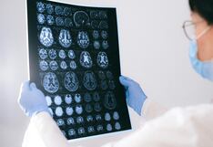 Estudio en Perú vincula exceso de hierro en la dieta con daño cerebral y mayor riesgo de Alzheimer